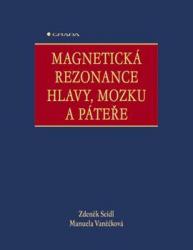 Magnetická rezonance hlavy, mozku a páteře