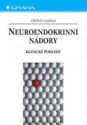 Neuroendokrinní nádory